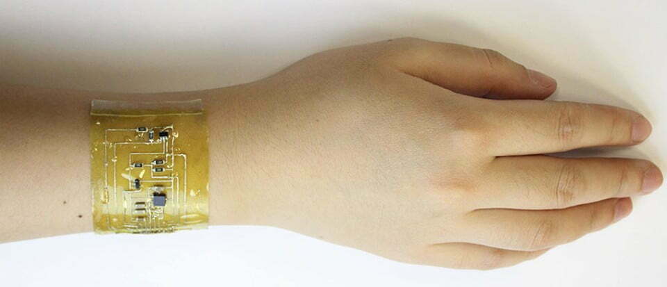 New ‘electronic skin’ is a recyclable, self-healing wearable device